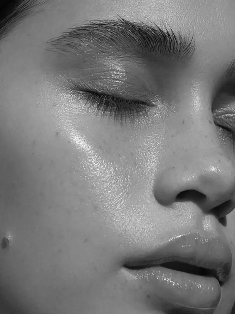 BioRePeel con Microneedling (Exosomas )