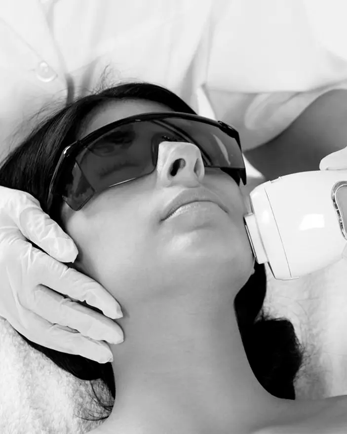 IPL Facial- Luz Pulsada Intensa